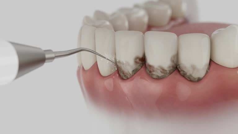 Reliable Dental contractor in Gregory, SD by Smile Center Dentistry